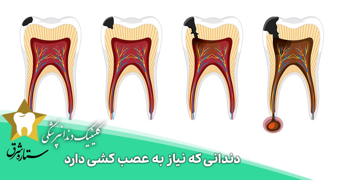 پوستر علائم هشدار که نیاز به مراجعه پزشکی دارد
